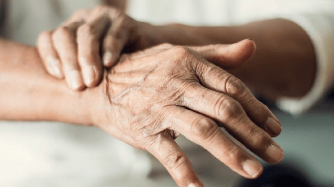 La Enfermedad de Parkinson se convierte en una preocupación creciente en México por la falta de diagnóstico adecuado.